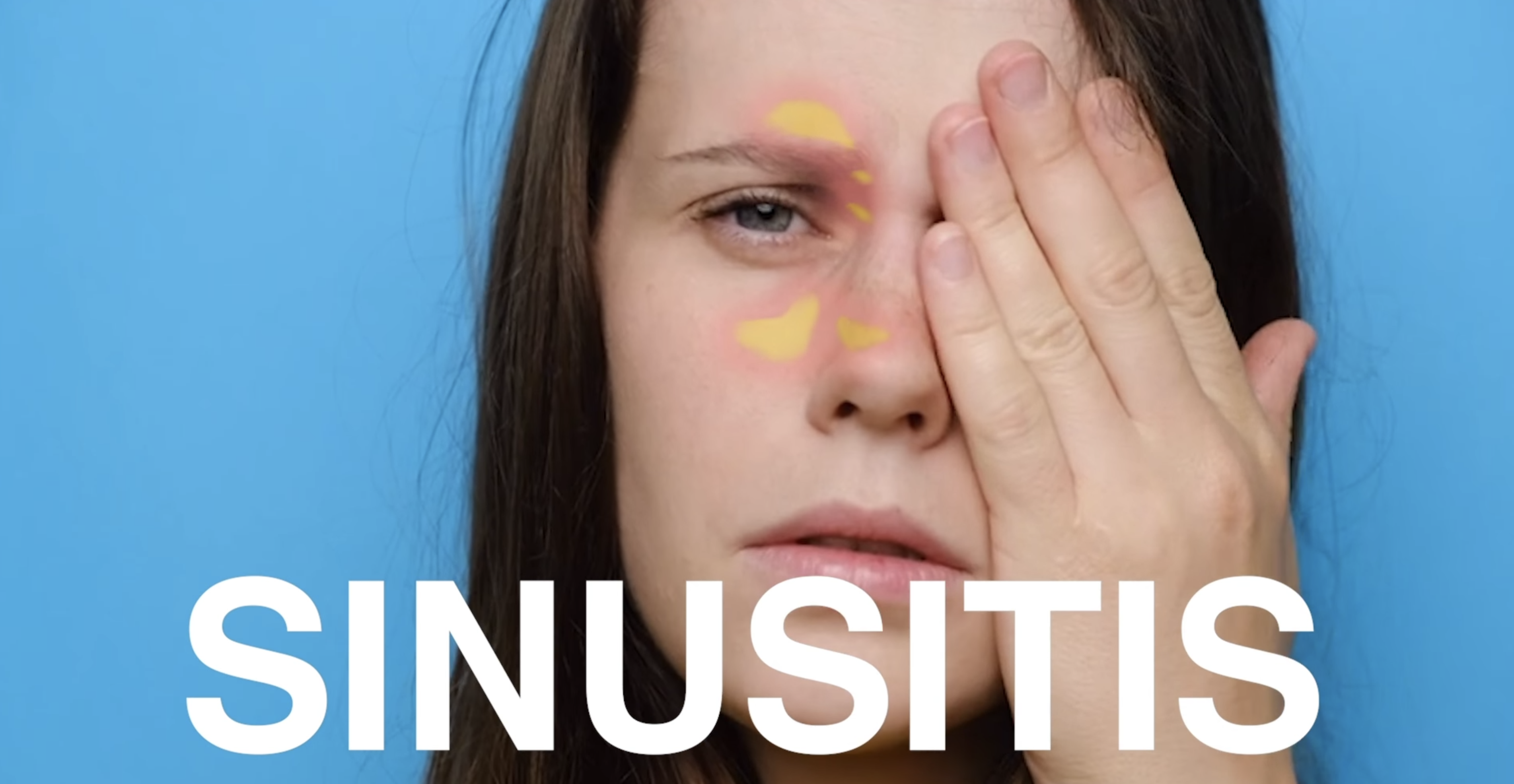 Nasodren es un producto indicado para la sinusitis