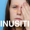 Sinusitis