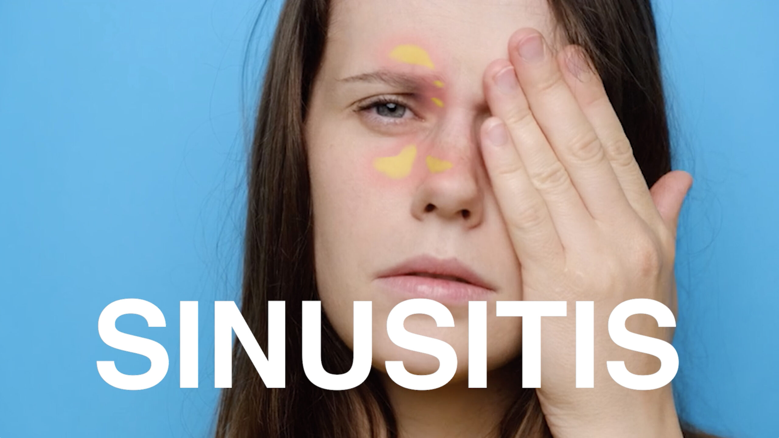 Sinusitis