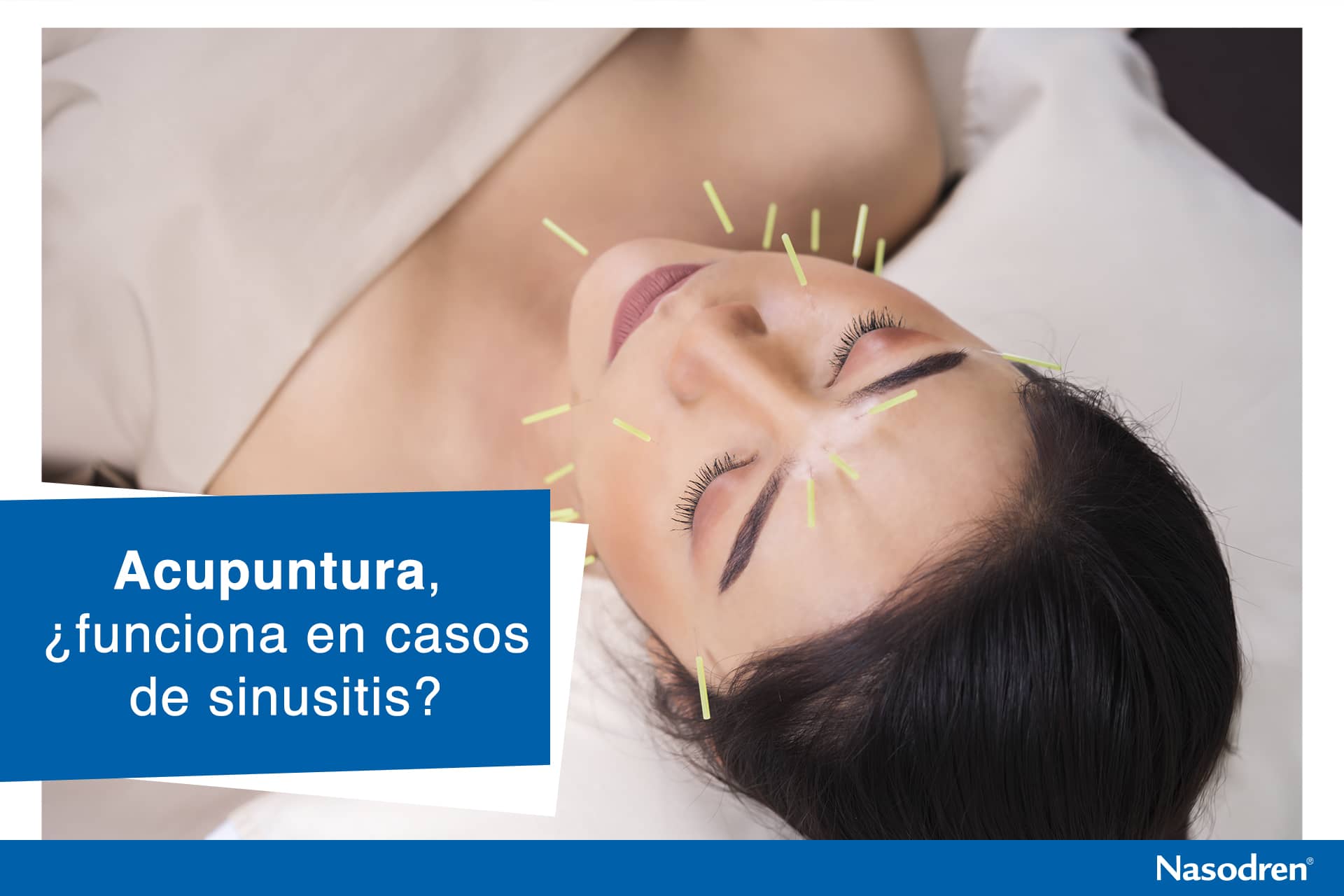 acupuntura en paciente de sinusitis