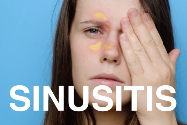 Sinusitis